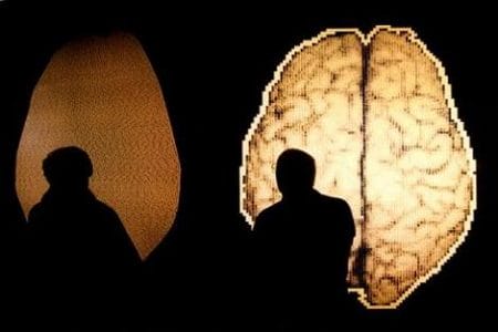 Diferencias entre el cerebro masculino y femenino